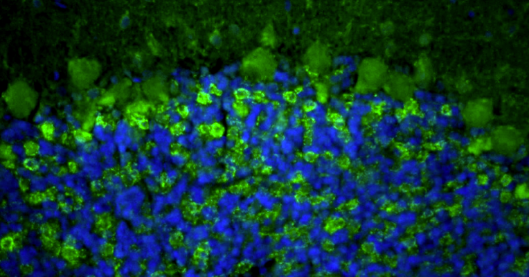 Representative FFPE section of rat brain cerebellum showing VGAT staining. The sections were stained with anti-VGAT recombinant chicken monoclonal antibody using goat anti-chicken IgY FITC secondary antibody (green). The stained sections were mounted with Fluoroshield (DAPI and DABCO) mounting medium. DAPI (blue) stains cell nuclei. Anti-VGAT stains the GABAergic terminals and neurons in the cerebellum. Magnification 400X.