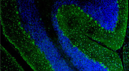 DAPI nuclear stain (blue) shows cell nuclei. Magnification 100X.