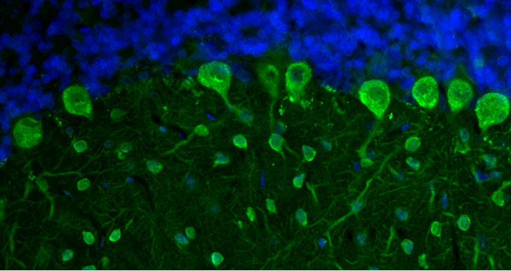 DAPI nuclear stain (blue) shows cell nuclei. Magnification 400X.