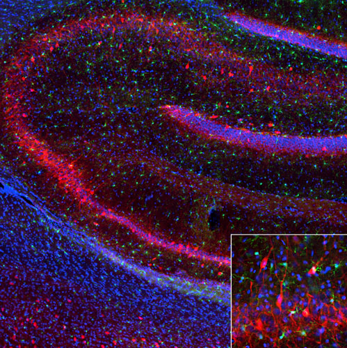 DAPI nuclear stain (blue) shows cell nuclei. Anti-Parvalbumin specifically stains the GABAnergic interneurons in the cerebellum.