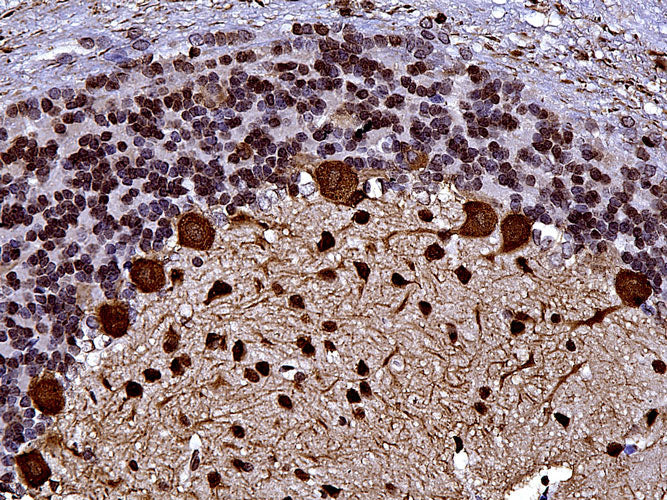 Anti-Parvalbumin specifically stains the Purkinje cells and other neurons in the molecular layer of the cerebellum. Magnification 400X.
