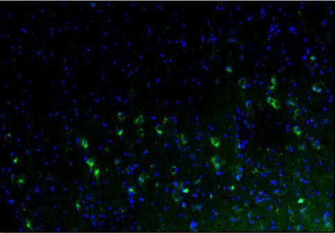 Representative section of formalin fixed, paraffin-embedded rat brain cerebral cortex showing cells stained by anti-Calretinin antibody. DAPI nuclear stain (blue) shows cell nuclei. Magnification 100X.