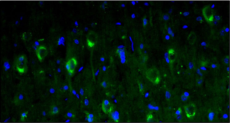 Representative section of formalin fixed, paraffin-embedded rat brain cerebral cortex showing staining cells by anti-Calretinin antibody. DAPI nuclear stain (blue) shows cell nuclei. Magnification 400X.