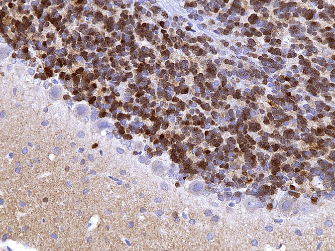 Anti-Calretinin specifically stains the interneurons in the granule cell layer of the cerebellum. Magnification 400X.