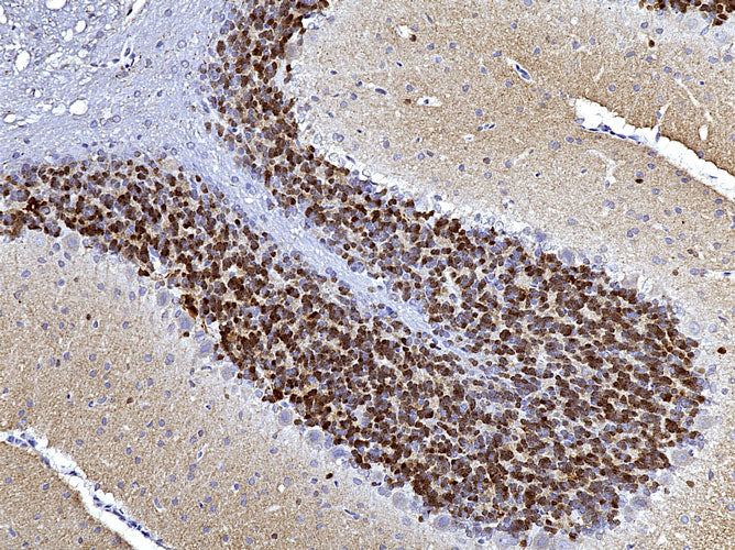 Anti-Calretinin specifically stains the interneurons in the granule cell layer of the cerebellum. Magnification 200X.