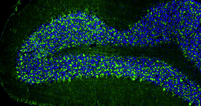 Representative section of formalin fixed, paraffin-embedded rat brain cerebellum region stained with anti-Bassoon recombinant chicken monoclonal antibody (green) at 1:100 dilution. DAPI nuclear stain (blue) shows cell nuclei. Anti-Bassoon stains the presynaptic sites on Purkinje cell dendrites in the molecular layer of the cerebellum. Magnification 100X.