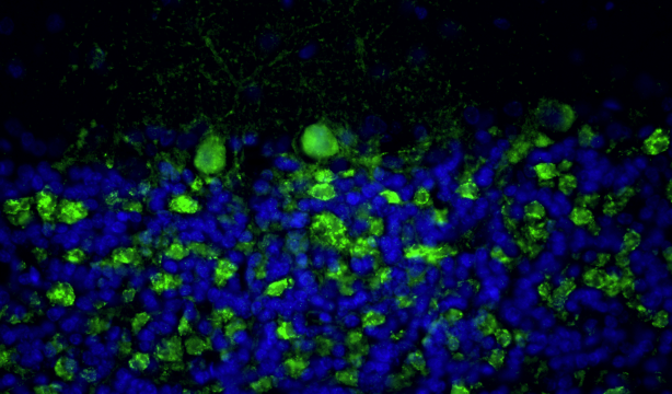 Representative section of formalin fixed, paraffin-embedded rat brain cerebellum region stained with anti-Bassoon recombinant chicken monoclonal antibody (green) at 1:100 dilution. DAPI nuclear stain (blue) shows cell nuclei. Anti-Bassoon stains the presynaptic sites on Purkinje cell dendrites in the molecular layer of the cerebellum. Magnification 400X.