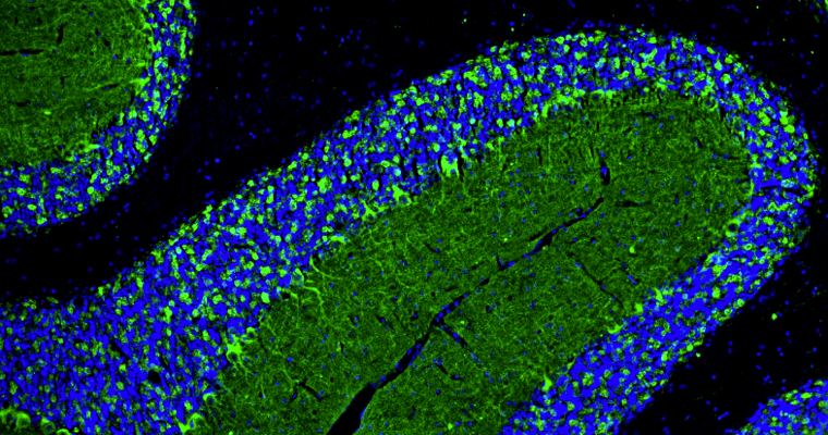 Representative section of formalin fixed, paraffin-embedded rat brain cerebellum stained with GAD65/67 recombinant chicken mAb (green) at 1:100 dilution. The stained sections were mounted with Fluoroshield mounting medium. DAPI (blue) shows cell nuclei. Anti-GAD65/67 stains neuropil granules identifying GABAergic synapses, Purkinje cell bodies, and the synaptic terminal of GABAergic interneurons in the molecular layer of the cerebellum. Magnification 100X.