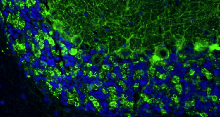 Representative section of formalin fixed, paraffin-embedded rat brain cerebellum stained with GAD65/67 recombinant chicken mAb (green) at 1:100 dilution. The stained sections were mounted with Fluoroshield mounting medium. DAPI (blue) shows cell nuclei. Anti-GAD65/67 stains neuropil granules identifying GABAergic synapses, Purkinje cell bodies, and the synaptic terminal of GABAergic interneurons in the molecular layer of the cerebellum. Magnification 400X.