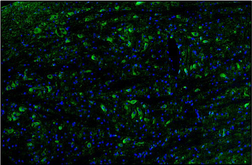 Representative section of formalin fixed, paraffin-embedded rat brain stem showing microglia cells stained by anti-TMEM119 antibody. DAPI nuclear stain (blue) shows cell nuclei. Magnification 100X.
