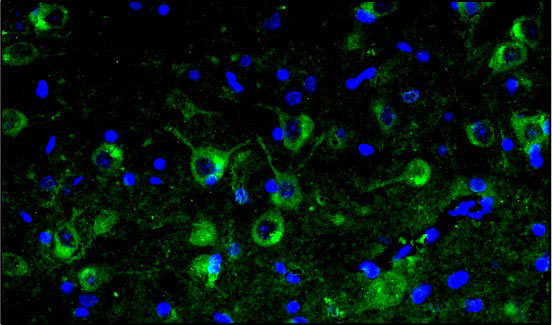 Representative section of formalin fixed, paraffin-embedded rat brain stem showing microglia cells stained by anti-TMEM119 antibody. DAPI nuclear stain (blue) shows cell nuclei. Magnification 400X.