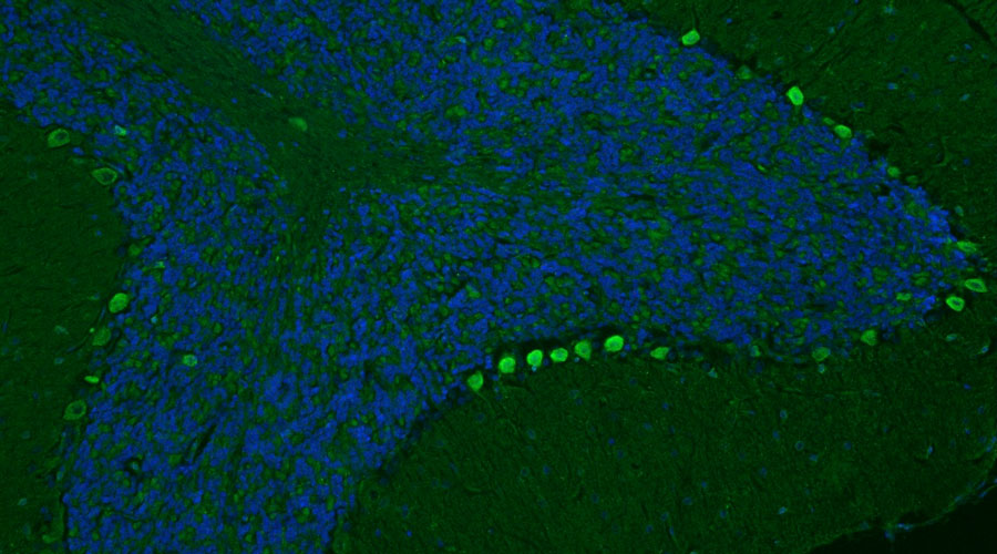 Chicken Anti-CSPG4/NG2 (Recombinant Chimeric)