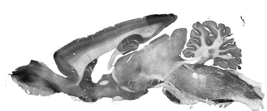Immunohistochemistry staining of adult rat brain section using anti-Cav2.3 mouse monoclonal antibody (Clone N493/22). The variable region of this antibody was used to generate recombinant chicken chimeric anti-Cav2.3 antibody.
