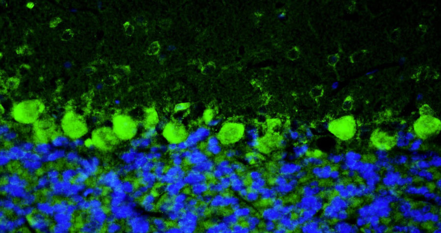 Chicken Anti-TMEM240 (Recombinant Chimeric)
