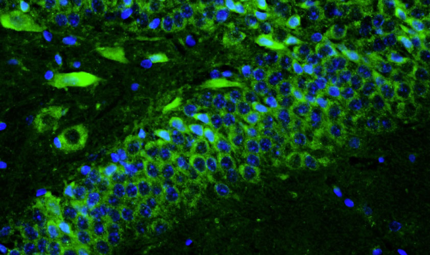 Chicken Anti-TMEM240 (Recombinant Chimeric)
