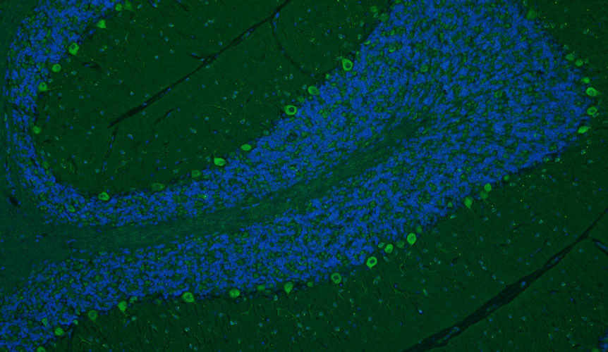 Chicken Anti-Cav1.2 Ca2+ Channel (Recombinant Chimeric)