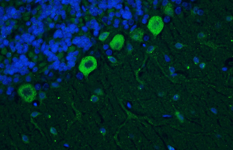 Chicken Anti-Cav1.2 Ca2+ Channel (Recombinant Chimeric)