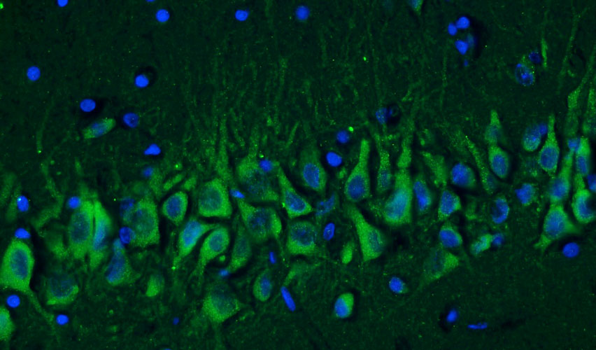 Chicken Anti-Cav1.2 Ca2+ Channel (Recombinant Chimeric)