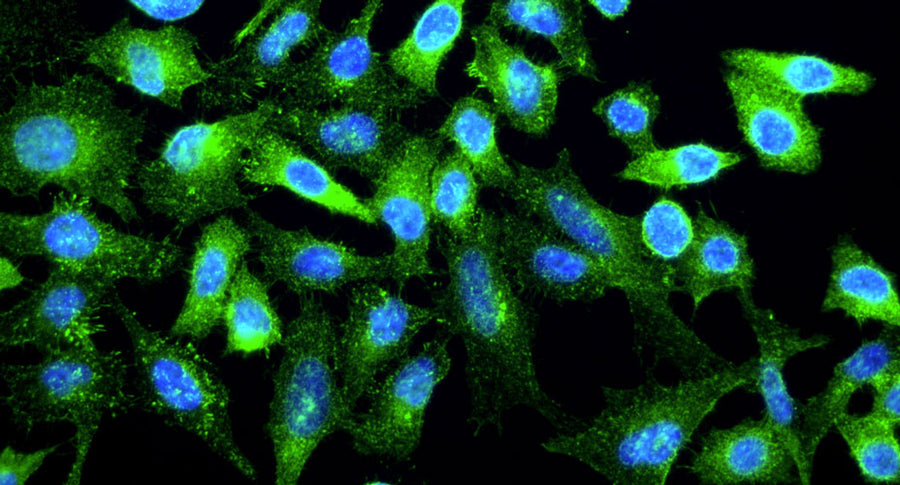 DAPI nuclear stain (blue) shows cell nuclei. Anti-Cortactin specifically stains the endogenous cortactin protein in HeLa cells.