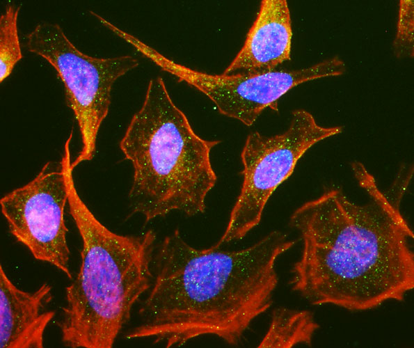 Actin filaments were stained using Phalloidin (red). DAPI nuclear stain (blue) shows cell nuclei. Anti-Rab9 specifically stains the late endosomes in HeLa cells.