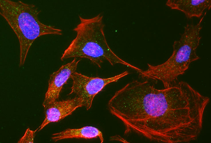 Actin filaments were stained using Phalloidin (red). DAPI nuclear stain (blue) shows cell nuclei. Anti-Rab9 specifically stains the late endosomes in HeLa cells.