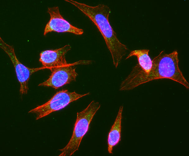 Actin filaments were stained using Phalloidin (red). DAPI nuclear stain (blue) shows cell nuclei. Anti-Rab9 specifically stains the late endosomes in HeLa cells.