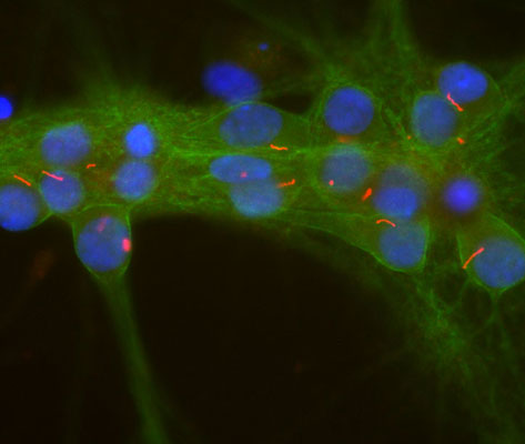 Immunostaining of cultured rat neurons and glia showing strong staining of neuronal cilia using our anti-adenylate cyclase III antibody 1:500, red) and axonal and dendritic staining of alpha II spectrin 1:500, green) revealing the submembranous cytoskeleton and DNA (blue).