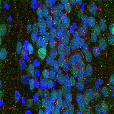 Immunofluorescence of a section of rat hippocampus selectively labeling the neuronal cilia with anti-adenylate cyclase III 1:10,000, red), labeling nuclei with anti-MECP2 1:1000,green), and Hoechst staining of nuclear DNA.