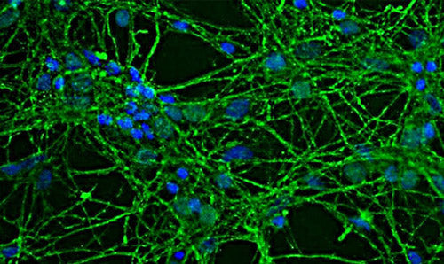 Immunofluorescence of rat neuron/glial culture labeling GAP43 protein 1:2000, green) expressed in the axonal membrane and synapses of neuronal cells. DAPI (blue) was used for nuclear staining.