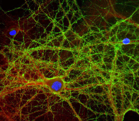 Immunolabeling of mixed neuron and glial cultures with anti-GAP43 1:2000, green), alpha II spectrin 1:1000, red) and nuclear staining with DAPI (blue). The anti-GAP43 labels protein expressed in the axonal membrane and synapses of neuronal cells. The Anti-αII-Spectrin labels the submembraneous cytoskeleton of axons and dendrites.