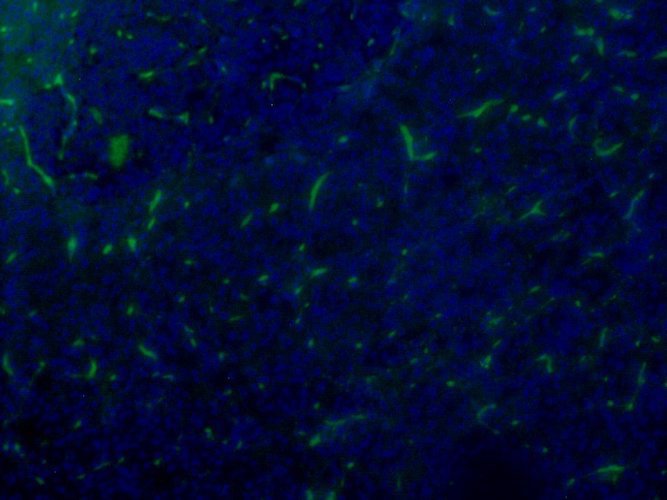 Mouse Anti-Vasoactive Intestinal Peptide