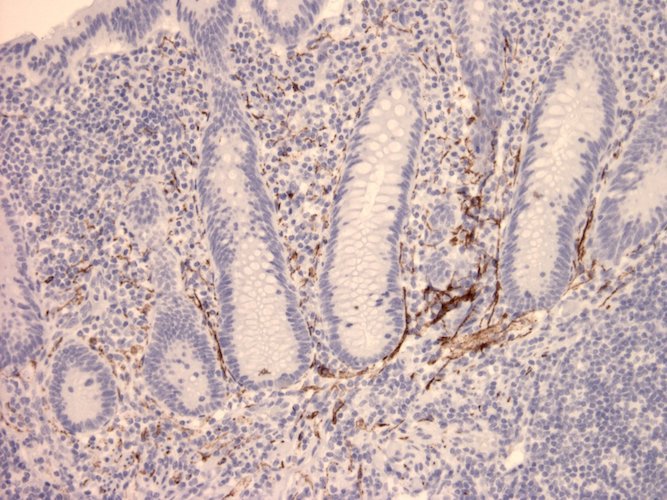 Mouse Anti-Vasoactive Intestinal Peptide