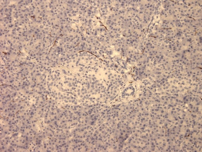 Mouse Anti-Vasoactive Intestinal Peptide