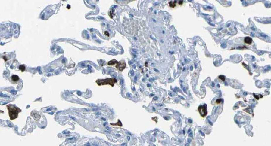 Mouse Anti-M-Ficolin