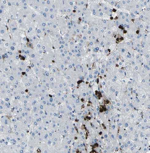 Mouse Anti-M-Ficolin