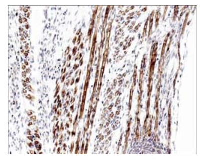 Formalin fixed, citric acid treated paraffin sections of E16 mouse skeletal muscle. Sections were probed with anti-Atrogin-1 then anti-Rabbit:HRP before detection using DAB. (Images provided by Carl Hobbs and Dr. Pat Doherty at Wolfson Centre for Age-Related Diseases, King's College London).