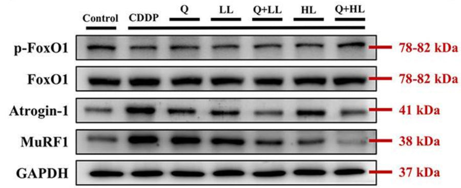 The individual and combined effect of quercetin (Q) and low dose (LL) or high dose (HL) of leucine on relative protein expression of p-FoxO1/FoxO1, Atrogin-1, and MuRF1 in the gastrocnemius muscle in BALB/c mice exposed to cisplatin (CDDP). Image from publication CC-BY-4.0. PMID: 37699022