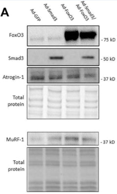 Representative Western blots for Atrogin-1 (1:1000) in rat ASM cells that were infected for 24 h with Ad-GFP, Ad-Smad3, Ad-FoxO3, or Ad-Smad3/Ad-FoxO3. Image from publication CC-BY-4.0. PMID: 37693008