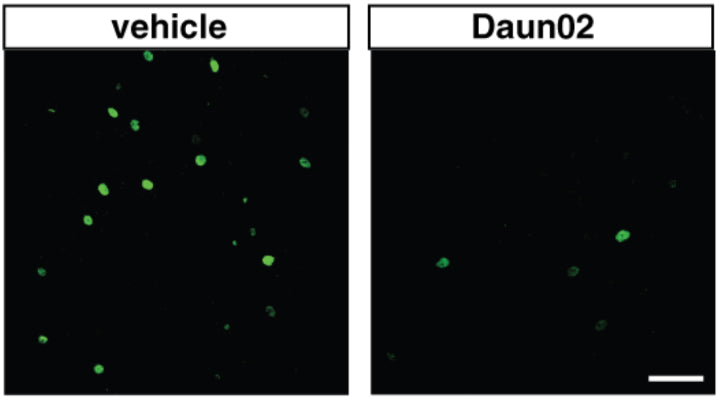 Transgenic rats that received vehicle (left panel) or Daun02 (right panel) were perfused 90 min after the last CS1 presentation and analyzed for the expression of β-galactosidase (β-gal) (1:1000). Image from publication CC-BY-4.0. PMID:38656872