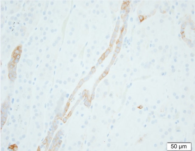 Mouse Anti-SCNN1G/Gamma-Subunit Epithelial Sodium Channel (Biotin Conjugate)