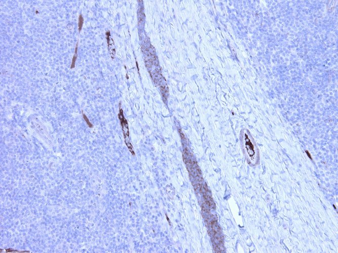 Mouse Anti-Complement C4c