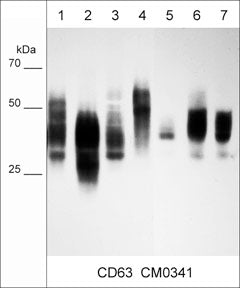 Immunocytochemical labeling of CD63 in paraformaldehyde fixed human MeWo melanoma cells. The cells were labeled with mouse monoclonal CD63. The antibody was detected using goat anti-mouse Ig DyLight® 594.