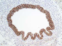 Formalin fixed, citric acid treated parafin sections of embryonic Rat E16 intestines. Sections were probed with anti-E-Cadherin then anti-mouse:HRP before detection using DAB. (Images provided by Carl Hobbs and Dr. Pat Doherty at Wolfson Centre for Age-Related Diseases, King's College London).