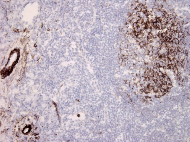 Mouse Anti-Complement C5b-9