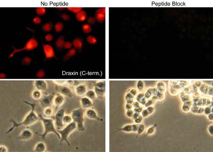 Immunocytochemical labeling of Draxin in rat PC12 cells differentiated with NGF. The cells were probed with Draxin (C-terminal region) rabbit polyclonal antibody, then the antibody was detected using appropriate secondary antibody conjugated to Cy3. The antibody was used in the absence (left) or presence (right) of blocking peptide. Lower images show corresponding phase images.