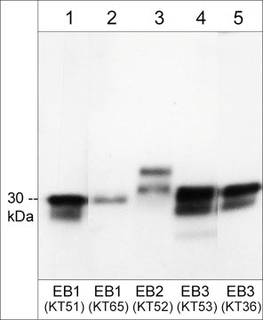 Western blot of EB proteins in mouse brain (lanes 1-5). The blot was probed with rat monoclonals anti-EB1 (lane 1), anti-EB1/2/3 (lane 2), anti-EB2 (lane 3), anti-EB3 (lane 4), and anti-EB3 (lane 5). Then the antibodies were detected using goat anti-Rat IgG Light Chain specific:HRP.