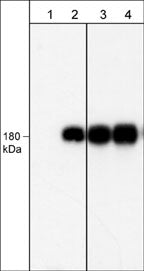 Western blot image of human A431 cells untreated (lanes 1 & 3) or treated with EGF (100 ng/ml) for 5 min. The blot was probed with anti-EGFR (Tyr-1101) monoclonal antibody (lanes 1 & 2) or anti-EGFR (Cytoplasmic) monoclonal antibody (lanes 3 & 4).