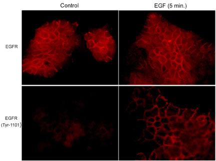Immunocytochemical labeling in A431 cells untreated or treated with EGF (100 ng/ml) for 5 min. The cells were labeled with mouse monoclonals anti-EGFR and anti-EGFR (Tyr-1101).