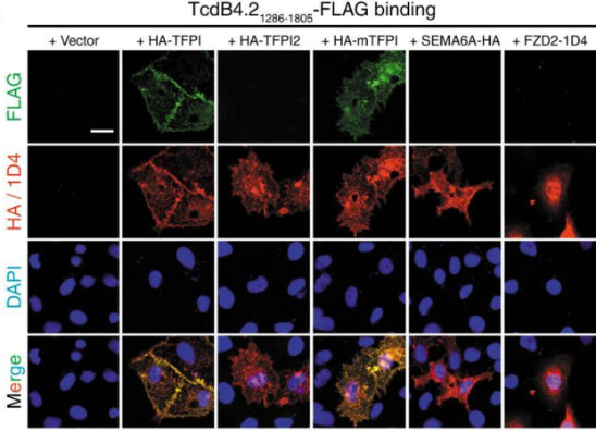 HeLa cells transiently transfected with TFPI, TFPI2, mTFPI, SEMA6A, or FZD2 were exposed to FLAG-tagged TcdB4.21286–1805 (5 µg/mL) on ice for 60 min, washed, fixed, permeabilized, and subjected to immunostaining analysis. Expression of exogenous proteins was confirmed by detecting fused HA) or 1D4 tag. Nuclei were labeled with DAPI (blue)