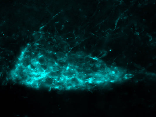 Immunolabeling of mouse hindbrain dorsal motor nucleus of the vagus (DMV) neurons expressing an hM3Dq-HA tag (Anti-HA Epitope Tag, 1:200). The image is kindly provided by Nicholas Conley, Neuroscience Graduate Program, University of Virginia.